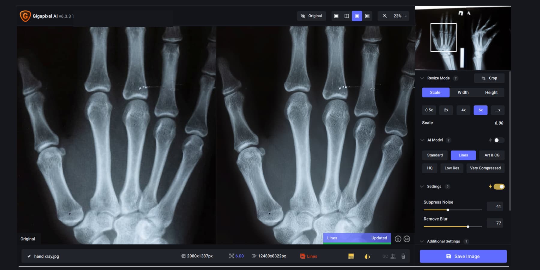 Une capture d'écran de Gigapixel AI améliorant une image radiographique de la main de quelqu'un