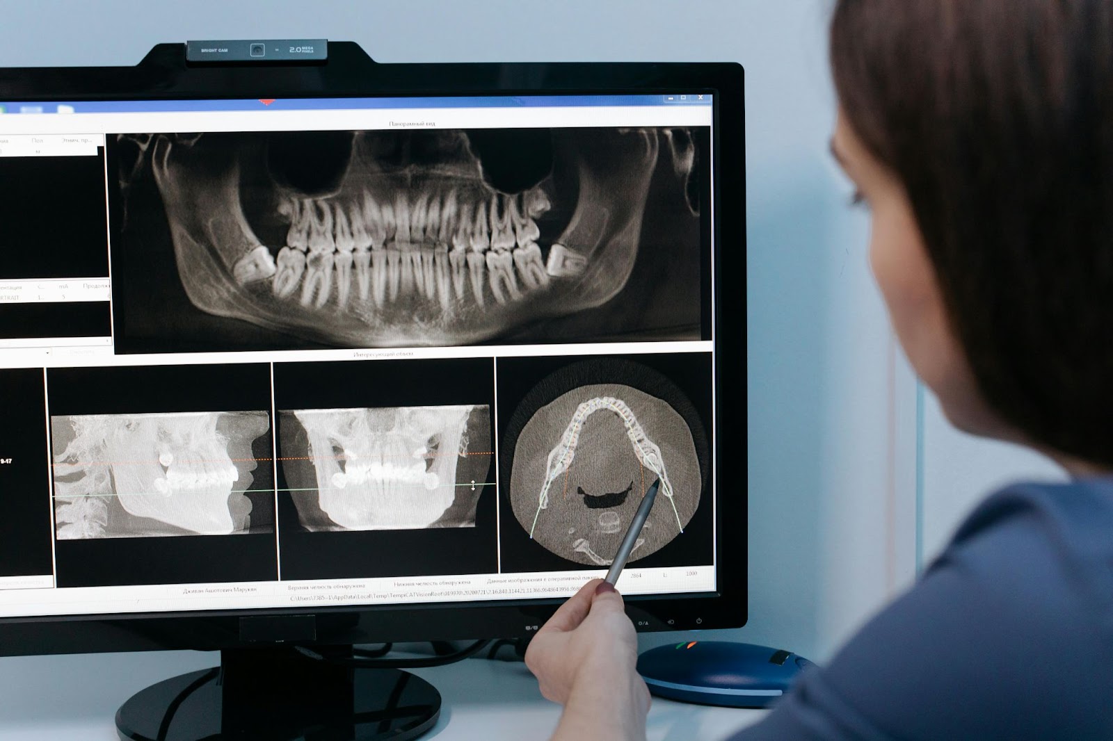 Dentista olhando as radiografias do paciente para determinar o tratamento.