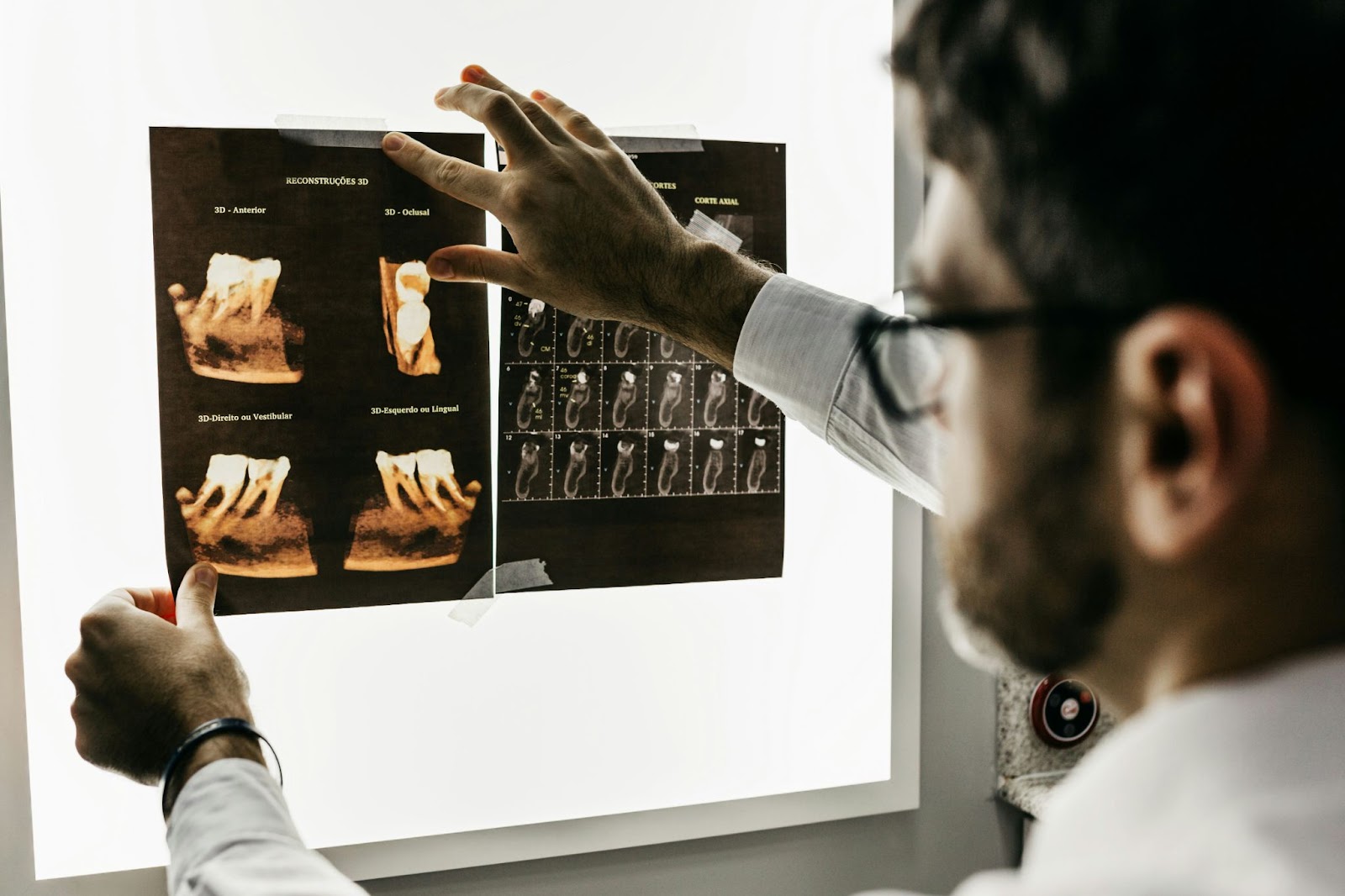 Un médico varón con gafas sosteniendo radiografías a contraluz para realizar una evaluación.