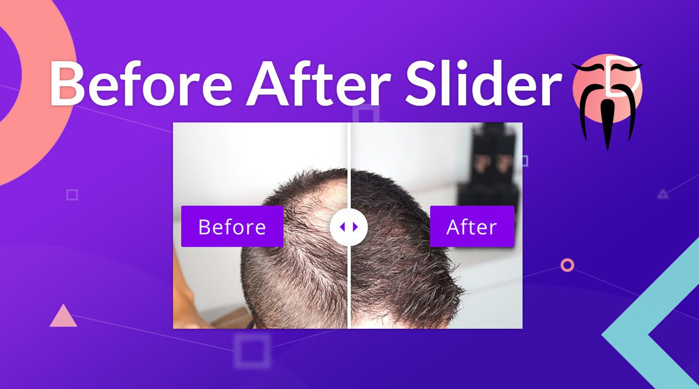 Immagine promozionale per Before After Slider